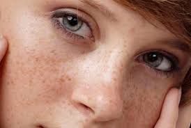 Rối loạn tuần hoàn não - Hình ảnh minh họa